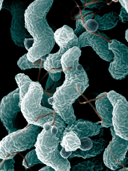 Comapre Campylobacter and Helicobacter