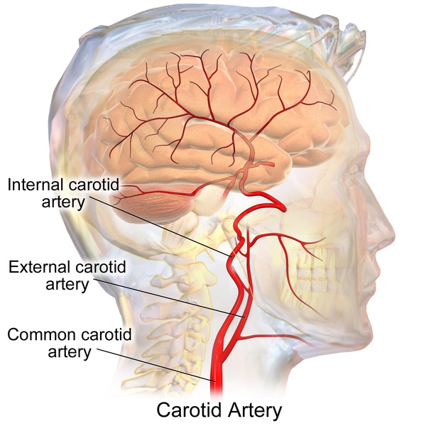 Coronary vs Carotid Artery