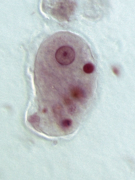 Compare Entamoeba Histolytica and Giardia Lamblia - What's the difference?