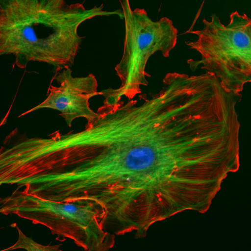  Compare Fluorescence and Epifluorescence Microscopy - What's the difference?