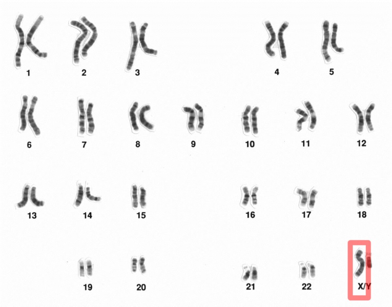 XX vs XY Chromosomes