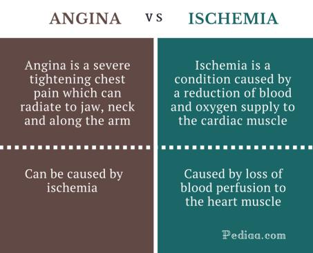 Difference Between Angina and Ischemia - Angina vs Ischemia Comparison Summary