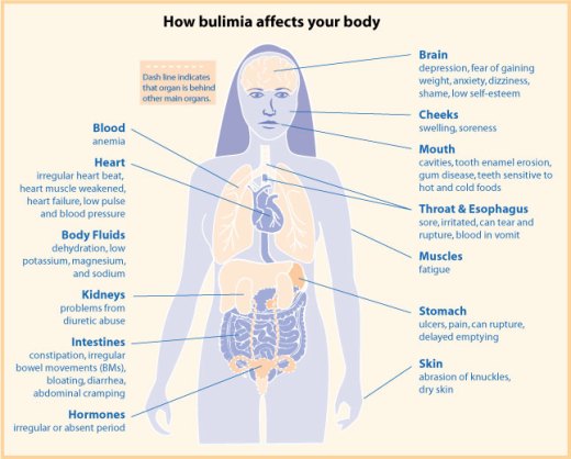 Difference Between Anorexia Nervosa and Bulimia Nervosa 