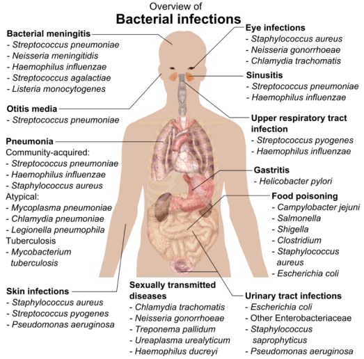 Difference Between Fungal and Bacterial Infection 