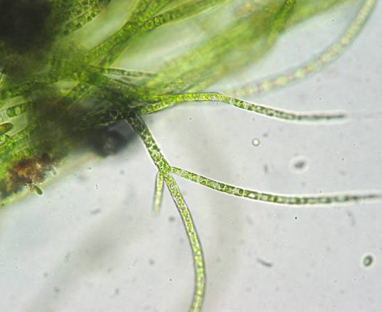 Main Difference - Green Algae vs Cyanobacteria 