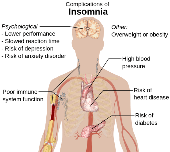 Main Difference - Insomnia vs Sleep Apnea 