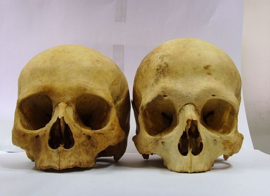 Main Difference - Male and Female Skeleton