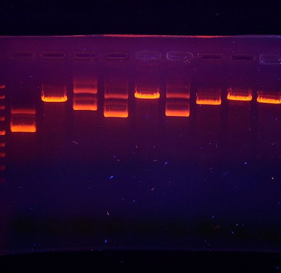 Main Difference - PCR vs RT PCR 