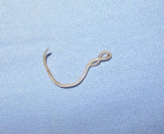Main Difference - Roundworm vs Tapeworm