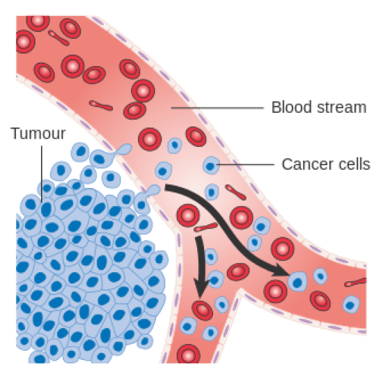 How Do Cancer Cells Spread 