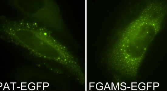 Main Difference - GFP vs YFP_Figure3