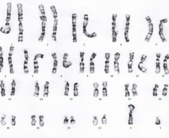 What is the Difference Between Maternal and Paternal Chromosomes_Figure 1