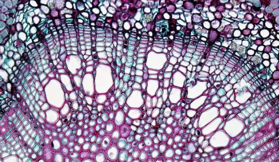 What is the Difference Between Primary Xylem and Secondary Xylem