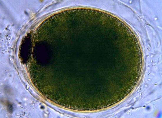 What is the Difference Between Protozoa and Helminths